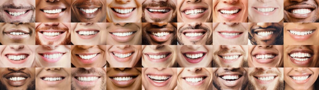 Viele Münder mit schönenen Zähnen - evidenzbasierte Zahnmedizin